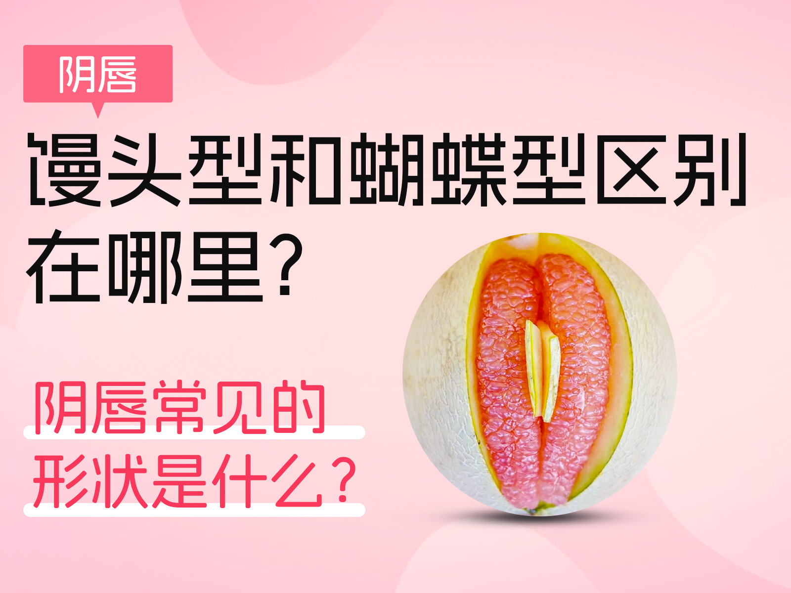 阴唇馒头型和蝴蝶型区别在哪里?阴唇常见的形状是什么？