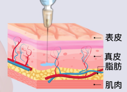 去韩国do脸靠谱吗？Elev/antian/soyou等皮肤科口碑好，值得推荐！